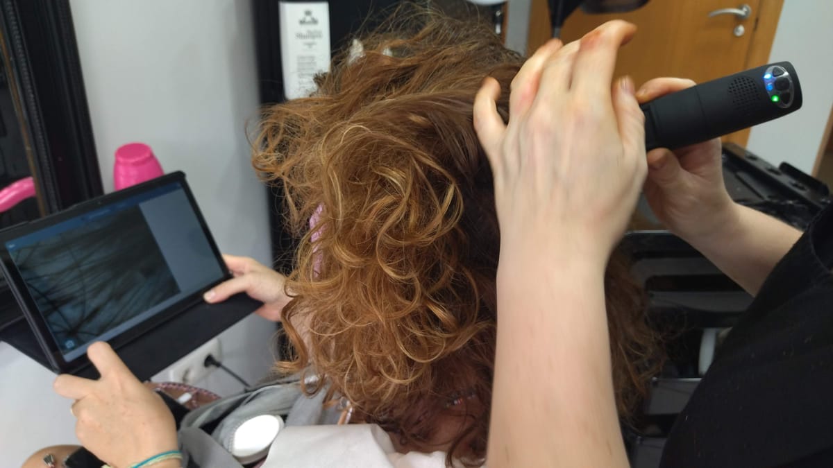 detección de anomalías capilares en cabello